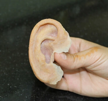 ear prosthesis